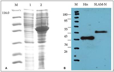 Development of an Enzyme-Linked Immunosorbent Assay Based on CD150/SLAM for the Detection of Peste des Petits Ruminant Virus